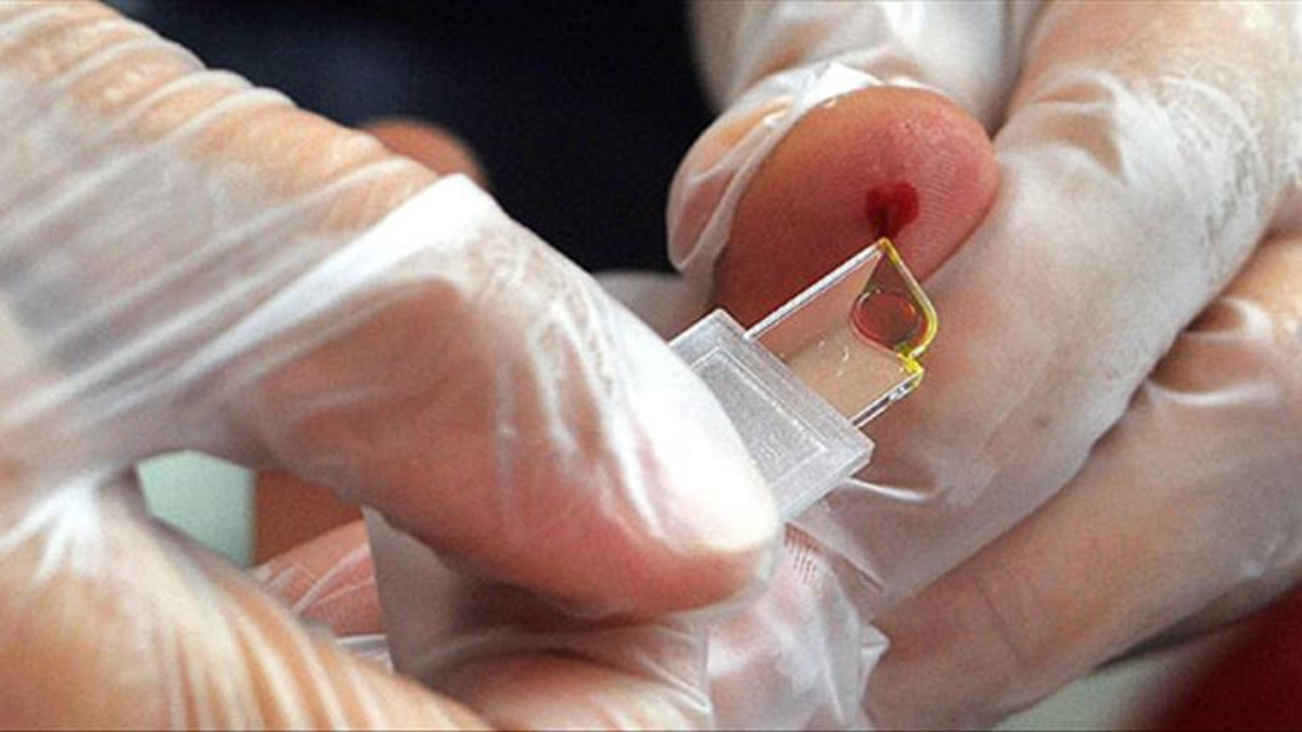 Nadir Rh-null Kan Grubu Laboratuvar Ortamında Üretiliyor Nadir Rh-null Kan Grubu Laboratuvar Ortamında Üretiliyor